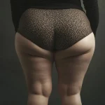 New Drug Combats the Muscle Loss Side Effect of Obesity Jabs